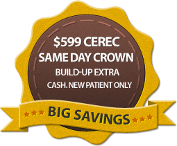 Temecula Crowns - Murrieta Dental Crowns