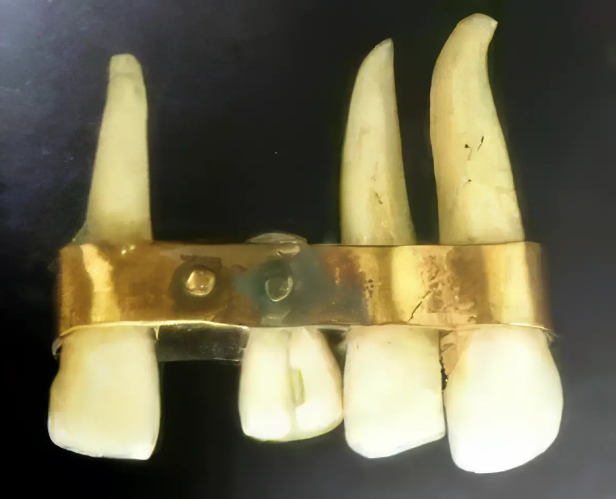 Ancient Maya jawbone with carved shell dental implants