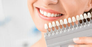  cosmetic dentistry - bleaching veneers 