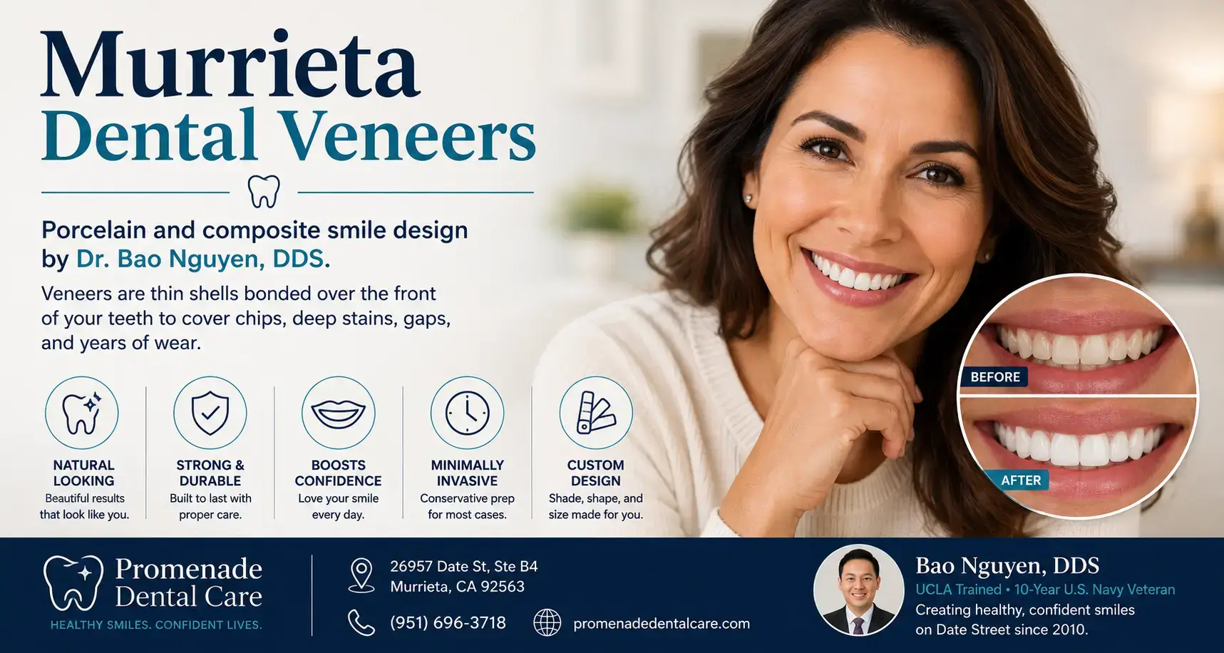 Close-up of a patient's smile after porcelain veneer treatment at Promenade Dental Care in Murrieta, CA