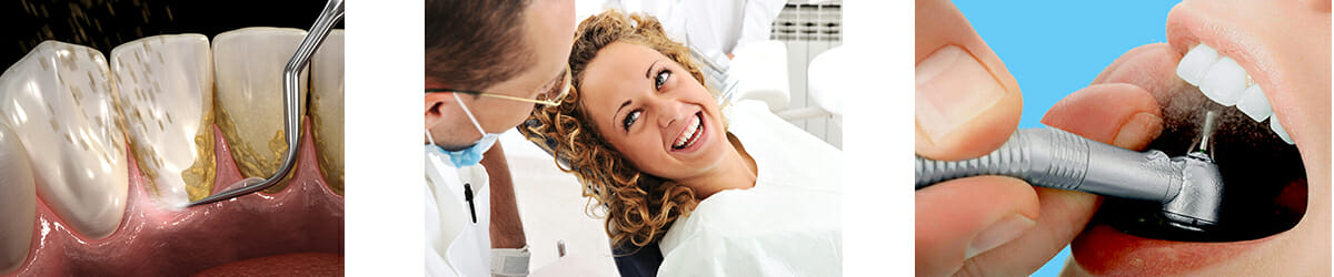 ultrasonic teeth cleaning