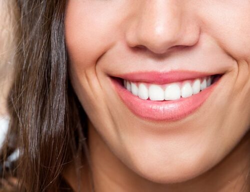 Discover the Benefits and Process of Murrieta Teeth Bonding