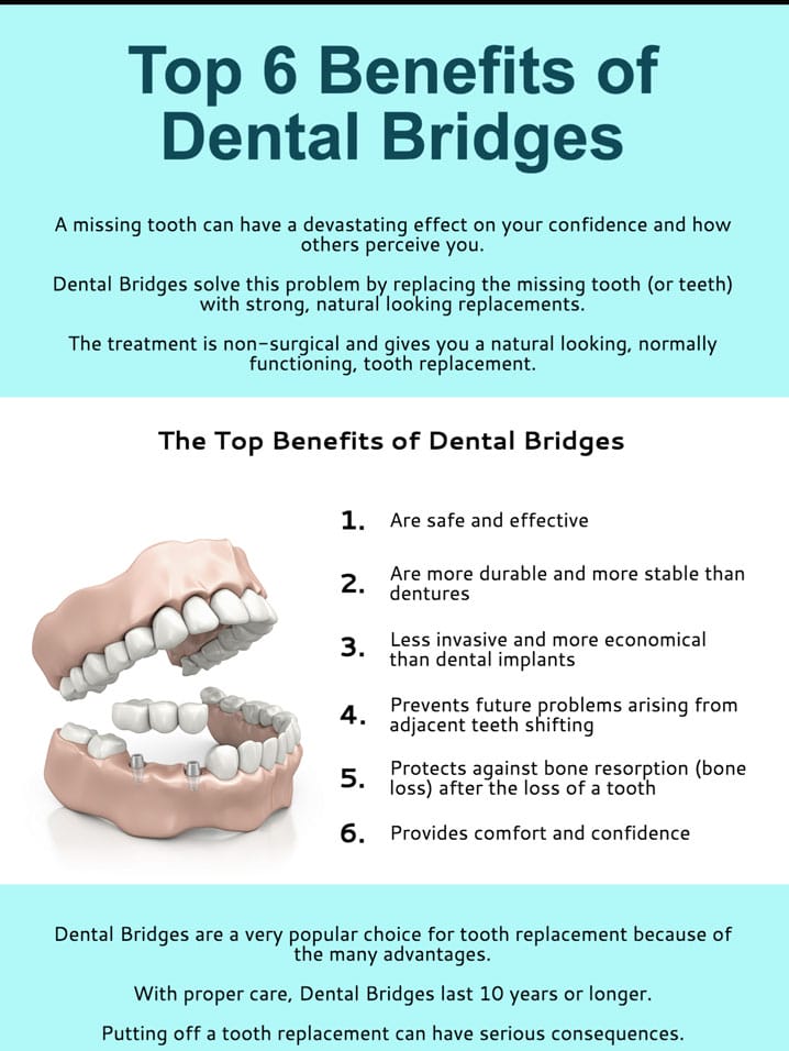 Murrieta Tooth Bridges