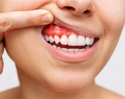 gum disease pain