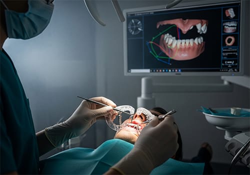 Murrieta computer guided dental implants