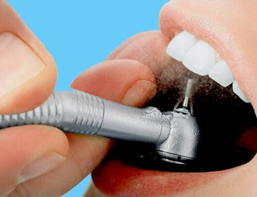 What are the most advanced teeth cleaning options available in Murrieta, including ultrasonic cleaning?