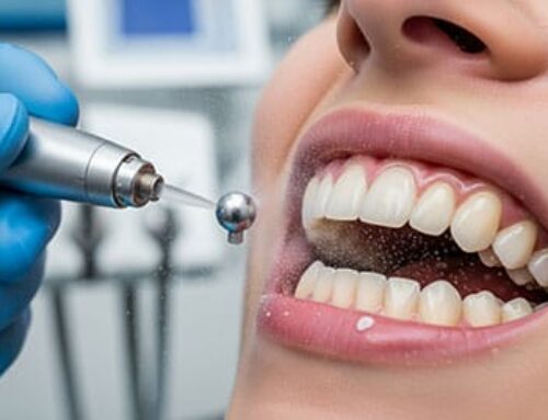 Frequently Asked Questions about Teeth Cleaning