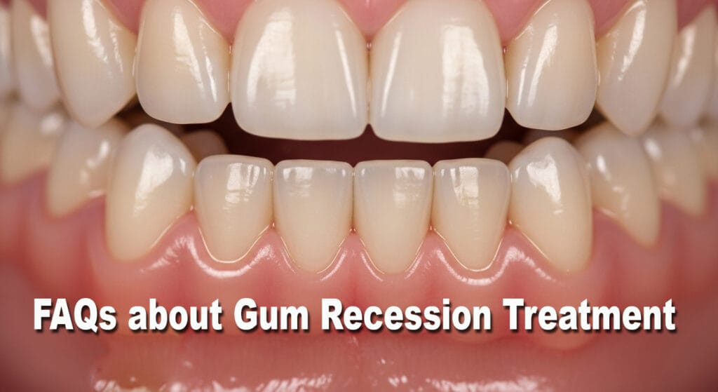 FAQs about gum recession treatment