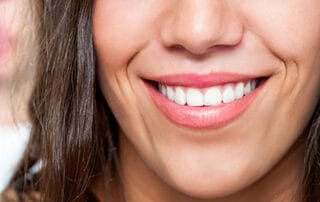 Teeth bonding tips
