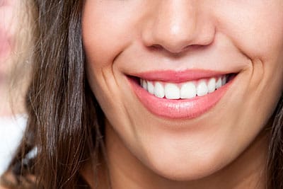 Teeth bonding tips