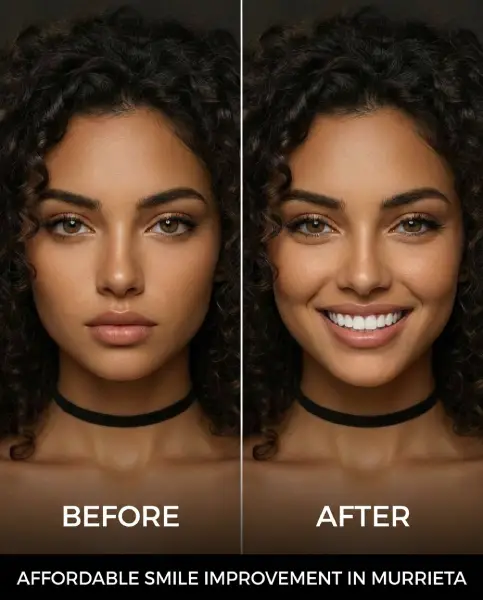 before and after affordable smile