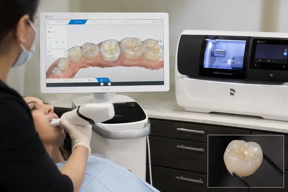 CEREC digital scanning and in-office milling of a same-day crown