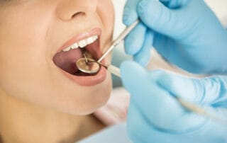 same-day crowns FAQs