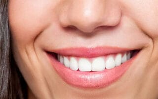 improve your smile