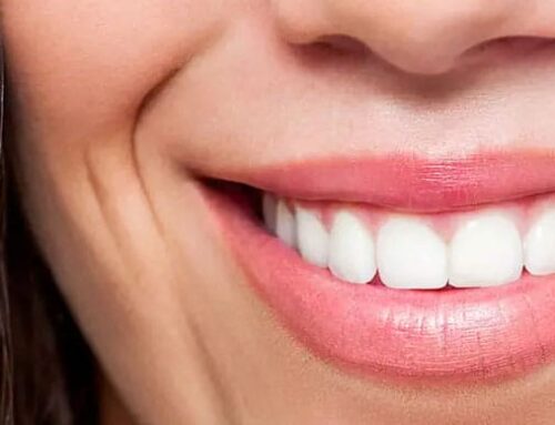 Promenade Dental Care is Now Offering Multiple Ways to Improve your Smile