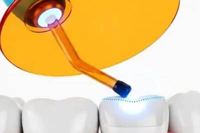 Murrieta tooth bonding