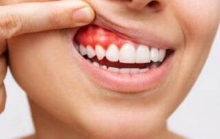 murrieta gum disease