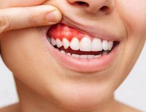 Early Gum Care for Cost-Effective Dental Health