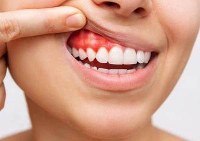 murrieta gum disease