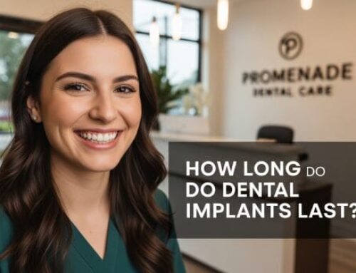 How Long Do Dental Implants Last? Murrieta, CA