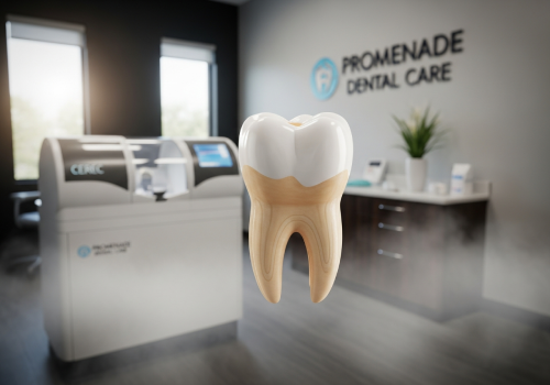 same day tooth from cerec