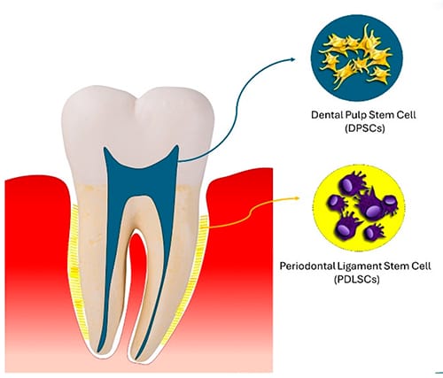 stem cell treatment for cavities