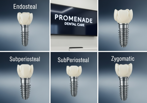 types of dental implants