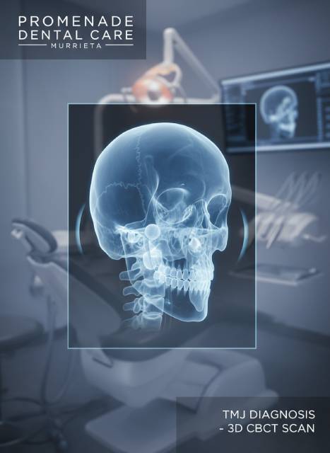 3D CBCT scan showing TMJ anatomy for diagnosis at Promenade Dental Care Murrieta