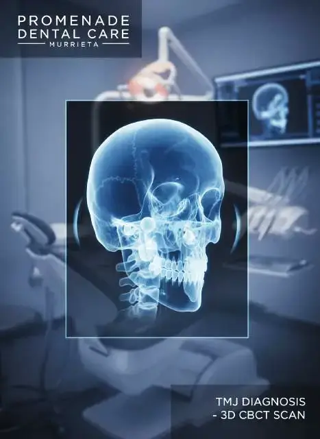 3D cone-beam CT scan used to evaluate the temporomandibular joint at Promenade Dental Care in Murrieta