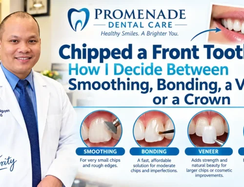 Chipped a Front Tooth? How I Decide Between Smoothing, Bonding, a Veneer, or a Crown