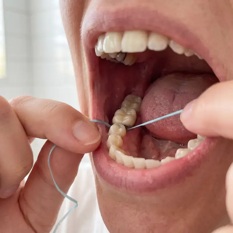 flossing around a crowned tooth